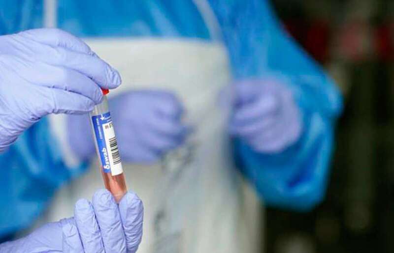 Análisis para determinar el Covid-19 (Foto TA)